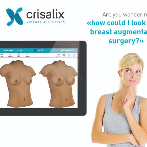 Crisalix VR 3D & 4D phần mềm mô phỏng giả lập trong phẫu thuật thẩm mỹ