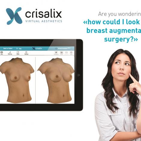 Crisalix VR 3D & 4D phần mềm mô phỏng giả lập trong phẫu thuật thẩm mỹ