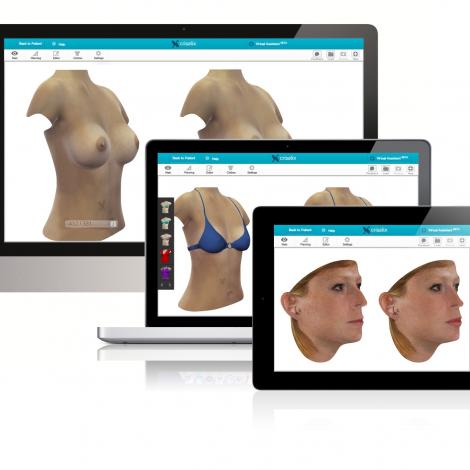 Crisalix VR 3D & 4D phần mềm mô phỏng giả lập trong phẫu thuật thẩm mỹ