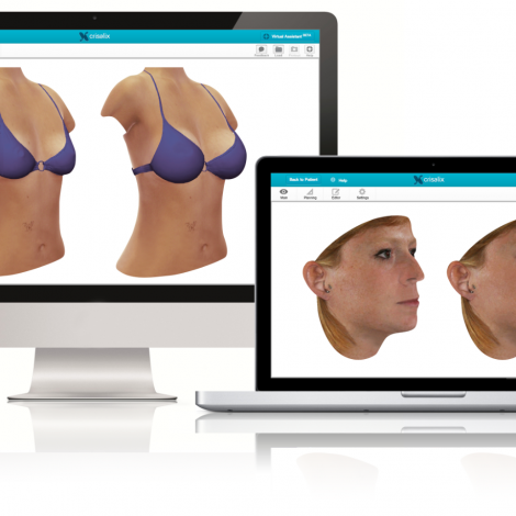 Crisalix VR 3D & 4D phần mềm mô phỏng giả lập trong phẫu thuật thẩm mỹ