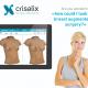 Crisalix VR 3D & 4D phần mềm mô phỏng giả lập trong phẫu thuật thẩm mỹ